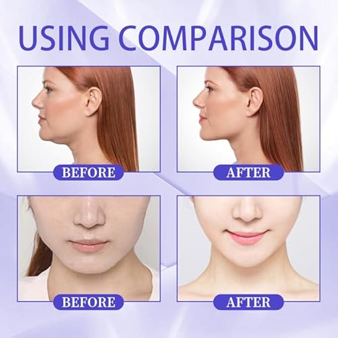 STRBOXONG 60PCS FACIAL INVISIBLE LIFTING PATCH, INVISIBLE FACE LIFTING FACIAL PATCHES, FACE LIFTING STICKERS, FIRMING THE SKIN, FADING FINE LINES, ANTI WRINKLE PLASTERS FOR MAKEUP, DOUBLE CHIN - Image 2